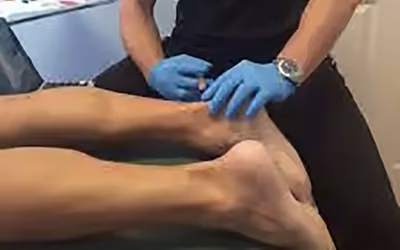 PRP-Injections-Tampa-e1597868190677-225×300-1 PRP-Injections-Tampa-e1597868190677-225x300-1